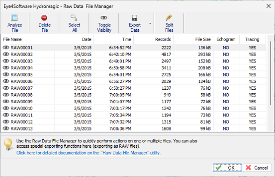 The raw data files manager shows a list of raw data files in the project