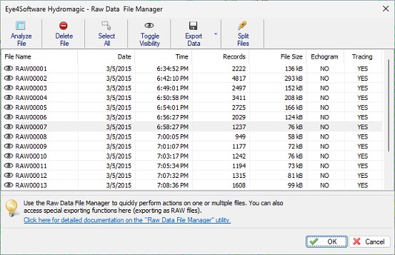 The interval log files manager shows a list of log files in the project